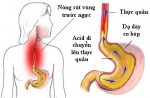 Lưu ý khi mắc chứng trào ngược dạ dày