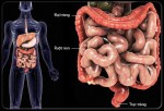 Hội chứng ruột kích thích: Lành tính nhưng khó trị, vì sao?