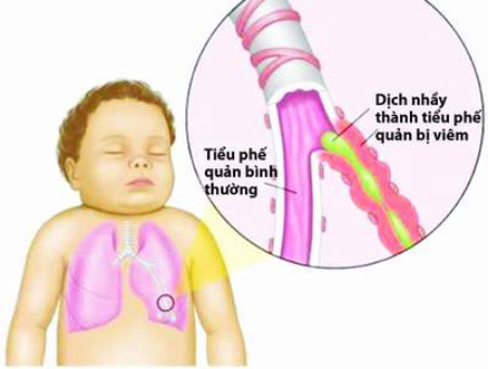 Hình minh họa từ Internet.