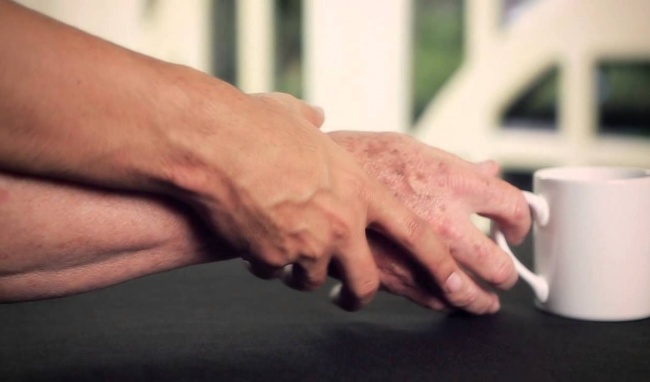 Nguy cơ bệnh tim mạch khi dùng thuốc trị Parkinson