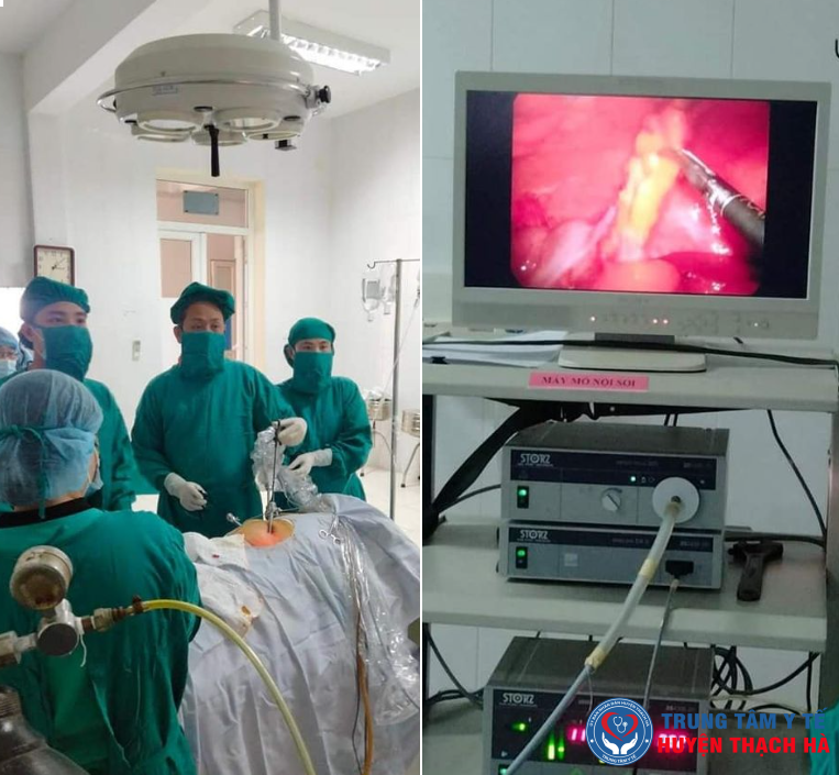 Phẫu thuật thành công ruột thừa  viêm cho bệnh nhân đảo ngược phủ tạng